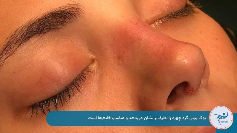 نوک بینی گرد مناسب خانمها
