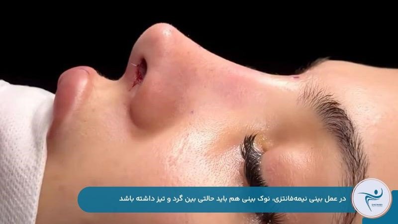نوک بینی نیمه گرد مناسب عمل بینی نیمهفانتزی