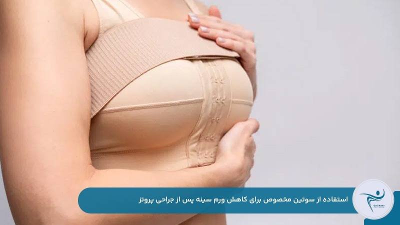 استفاده از سوتین مخصوص برای کاهش ورم سینه پس از جراحی پروتز