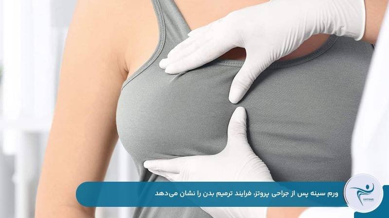 ورم سینه بعد از جراحی پروتز به‌دلیل فرایند ترمیم بدن